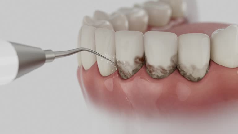 Reliable Emergency Dentist contractor in Crowley, TX by Smile Center Dentistry